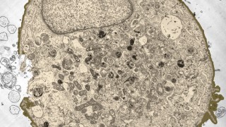 Mysterious Cloud-Like Blobs Gather Inside Cells Researchers Call for Investigation