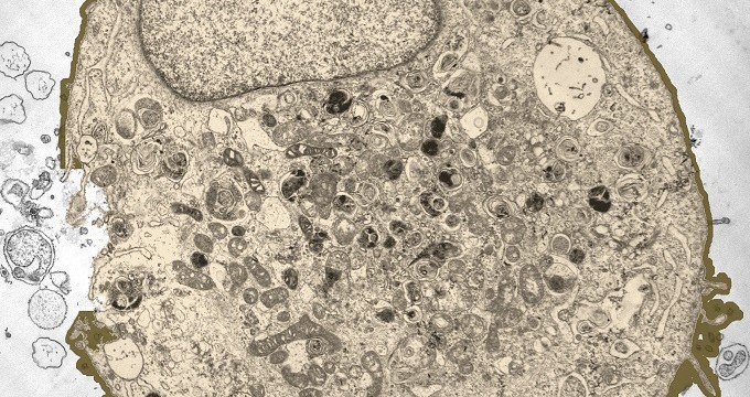 Mysterious Cloud-Like Blobs Gather Inside Cells Researchers Call for Investigation