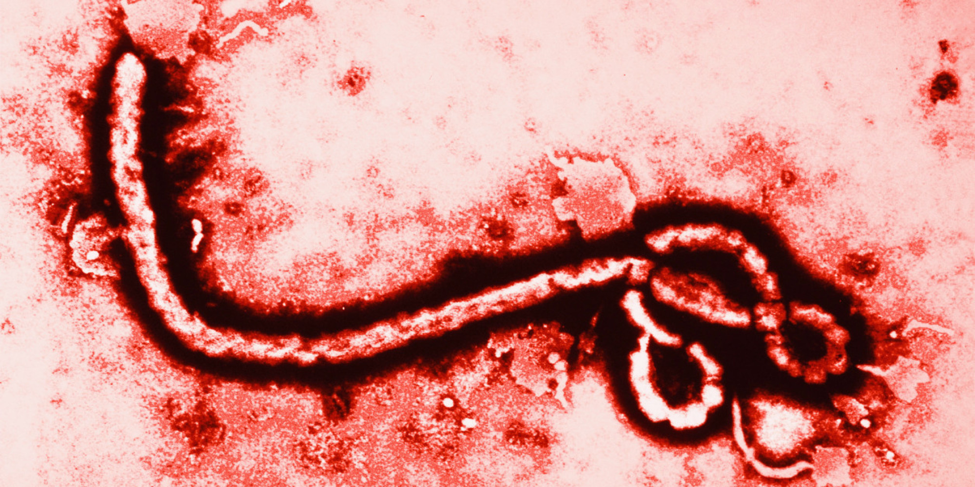 Ebola Cure Claimed by Chinese Scientists