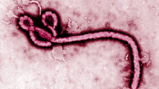 Ebola virus under microscope