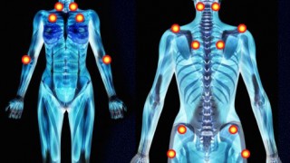 Fibromyalgia Patients Found to Have Reduced Brain Connectivity