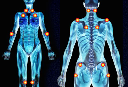 Fibromyalgia Patients Found to Have Reduced Brain Connectivity