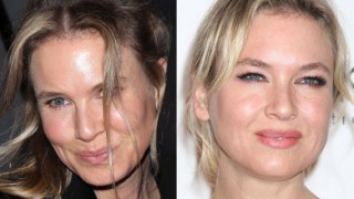Rene Zellweger's Shocking Face Change