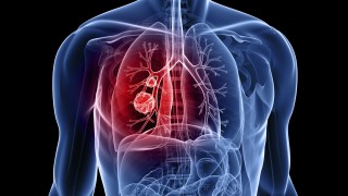 New Report: Cancer Cells Reprogrammed to Self-Destruct