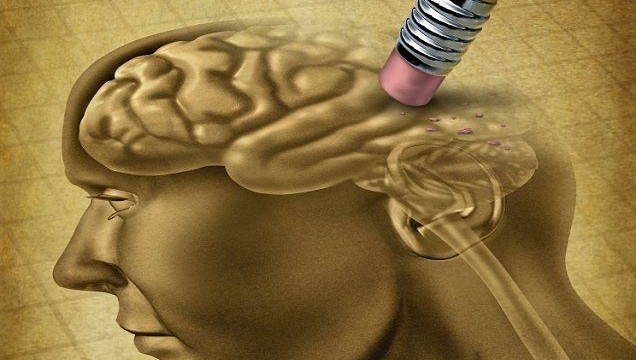 Alzheimer's brain erased with eraser