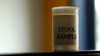 Photstock of a stool sample